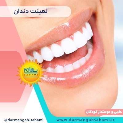 لمینت دندان در شیراز