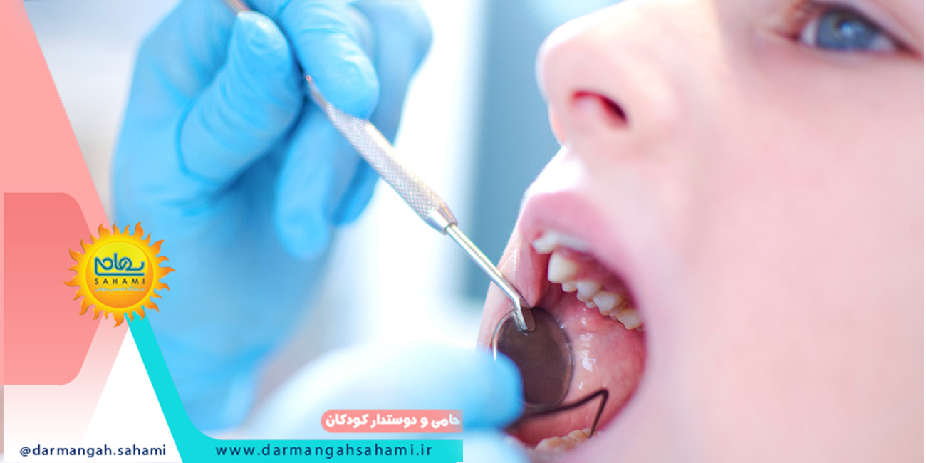 راه های جلوگیری از آبسه دندان شیری در کودکان