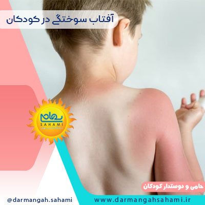 آفتاب‌ سوختگی در کودکان