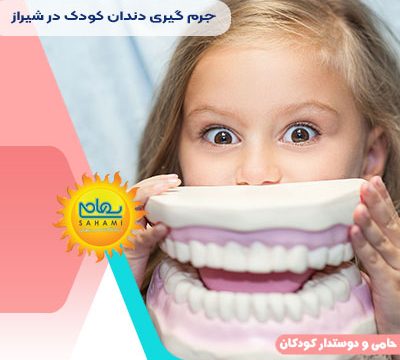 جرم گیری دندان کودک در شیراز