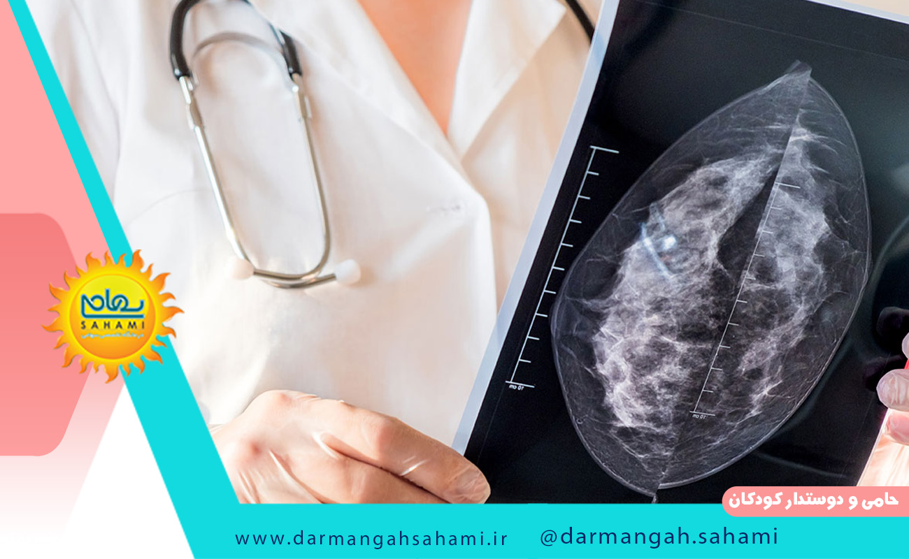 هر آنچه که باید در مورد ماموگرافی بدانید