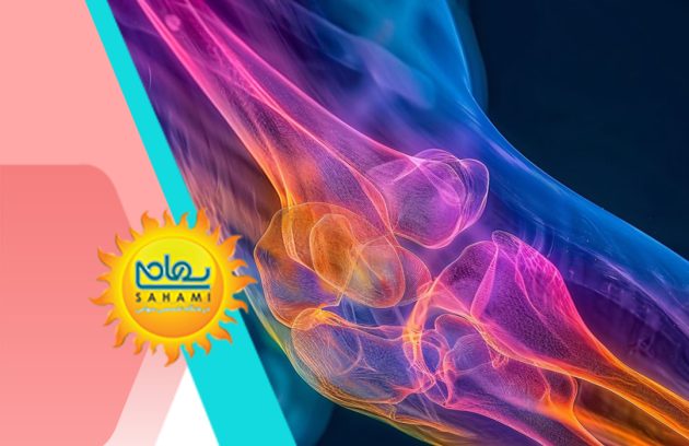 روماتیسم مفصلی